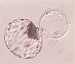 胚盤胞,漢方（相模原 漢方 鍼灸 接骨 タナココ）