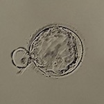 胚盤胞,PGT-A＜相模原 漢方 鍼灸 接骨 タナココ＞