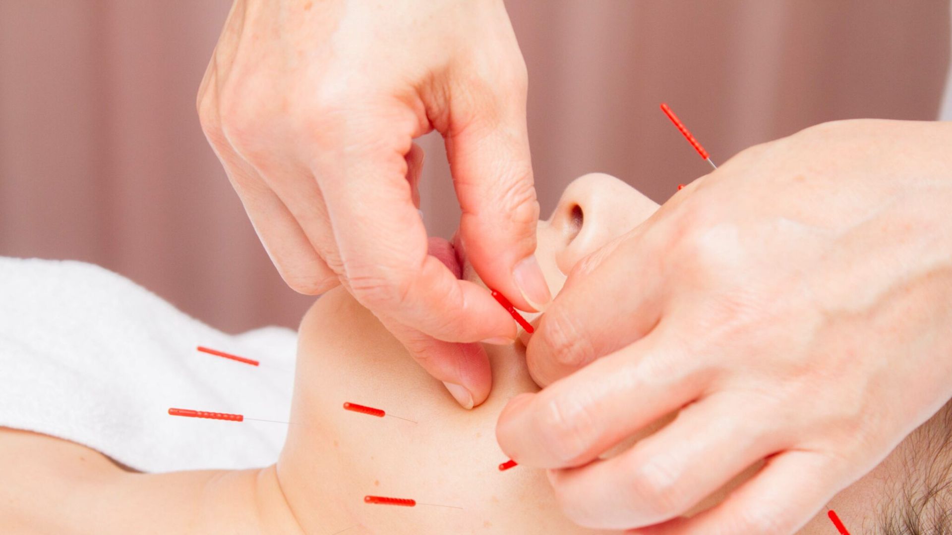 妊活鍼灸６＜相模原 漢方 鍼灸 接骨 タナココ＞