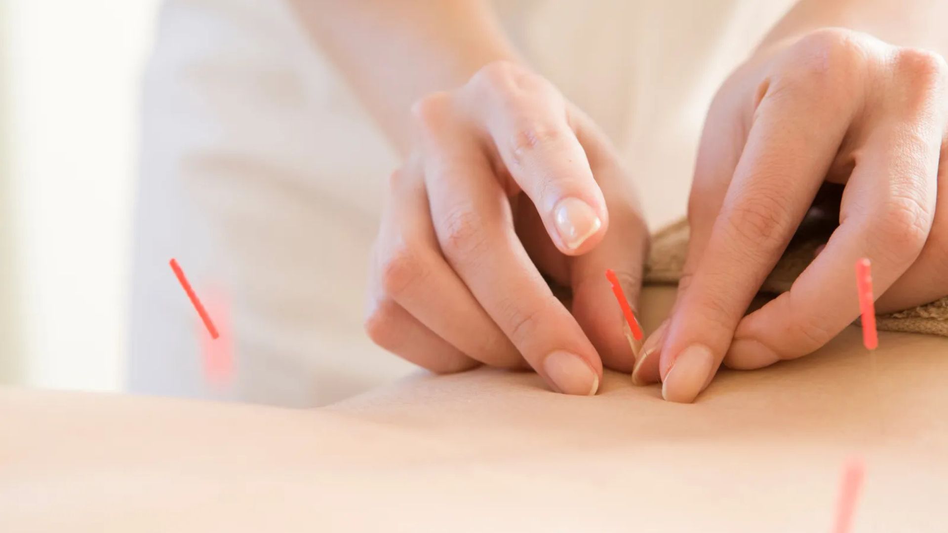 妊活鍼灸３＜相模原 漢方 鍼灸 接骨 タナココ＞